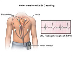 24-hour ECG Holter Monitoring Service - ECG on Demand